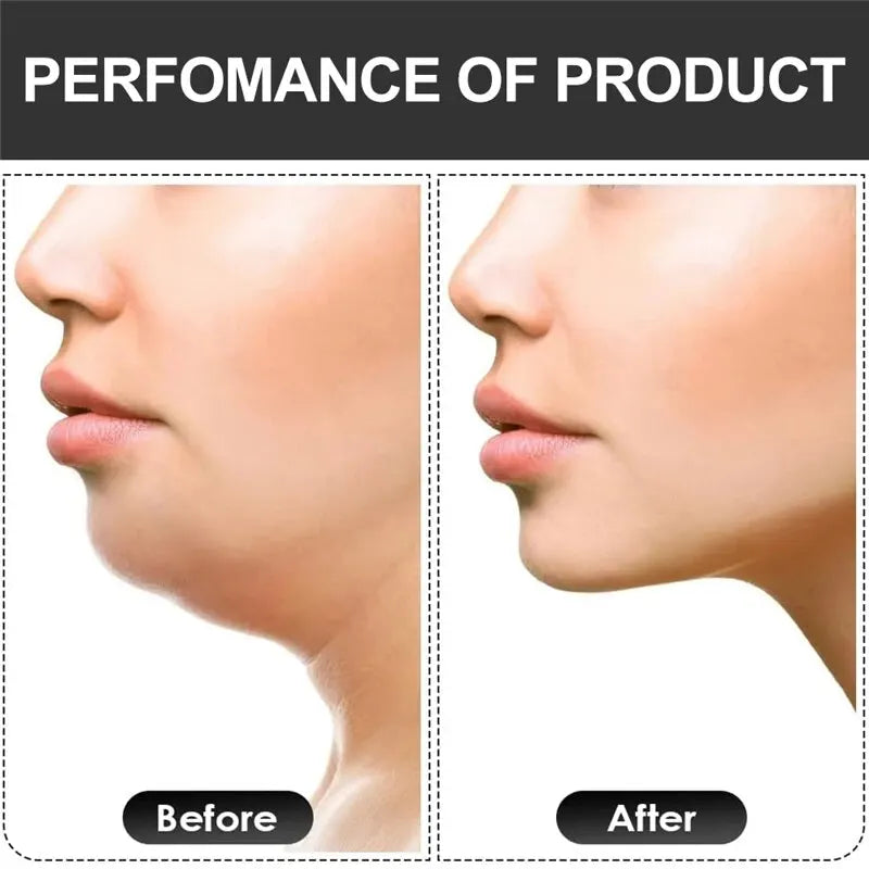 Fitness Jaw Exerciser Slim & Tone Jawline/Double Chin Reducer-Helps Reduce Teeth Grinding & Stress-Facial Toner/Look Youthful